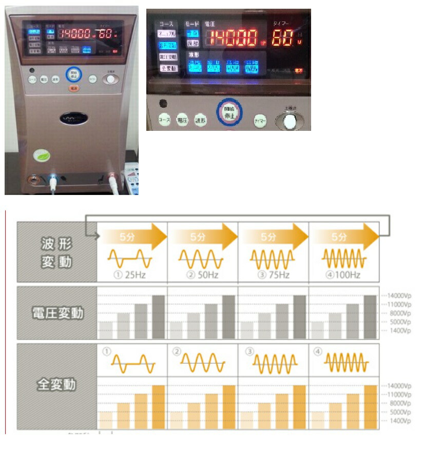 楽天市場】インプレックス イアス30000 5年保証【送料無料】 IMPREX
