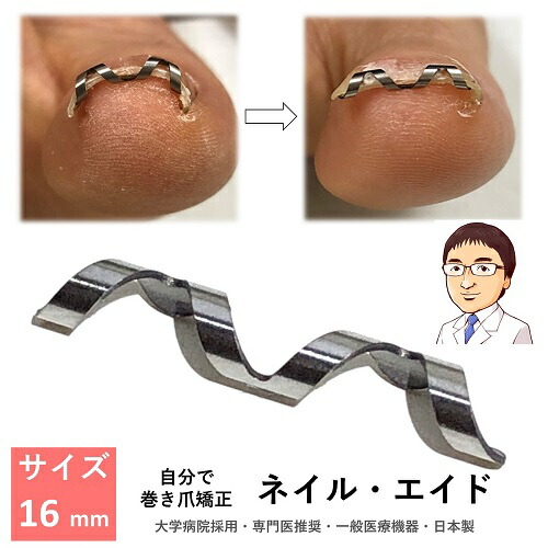 楽天市場】巻き爪 矯正 自分で 治療 【 ネイル・エイド 16mm