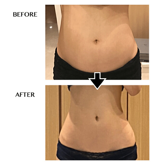 楽天市場】セルゼロ CELLZERO セルゼロバック CELLZERO BAG 美顔器