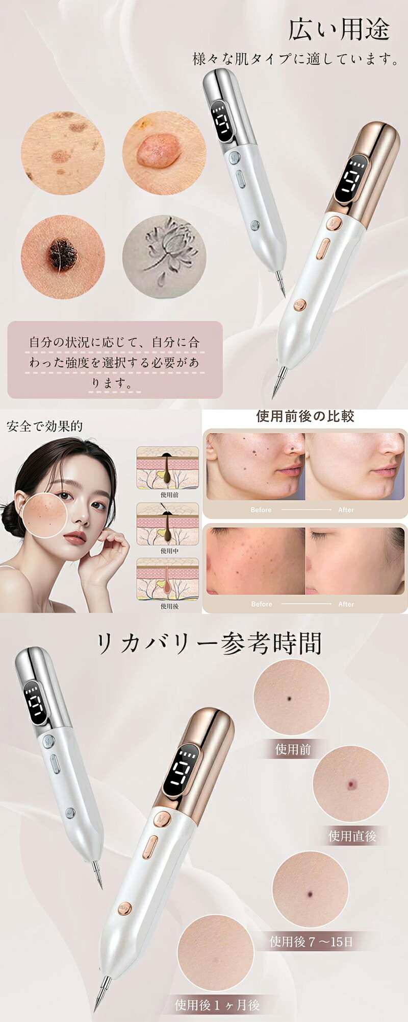 楽天市場】【【即納】美顔器 美顔ペン 9段階レベル USB充電式 美顔器