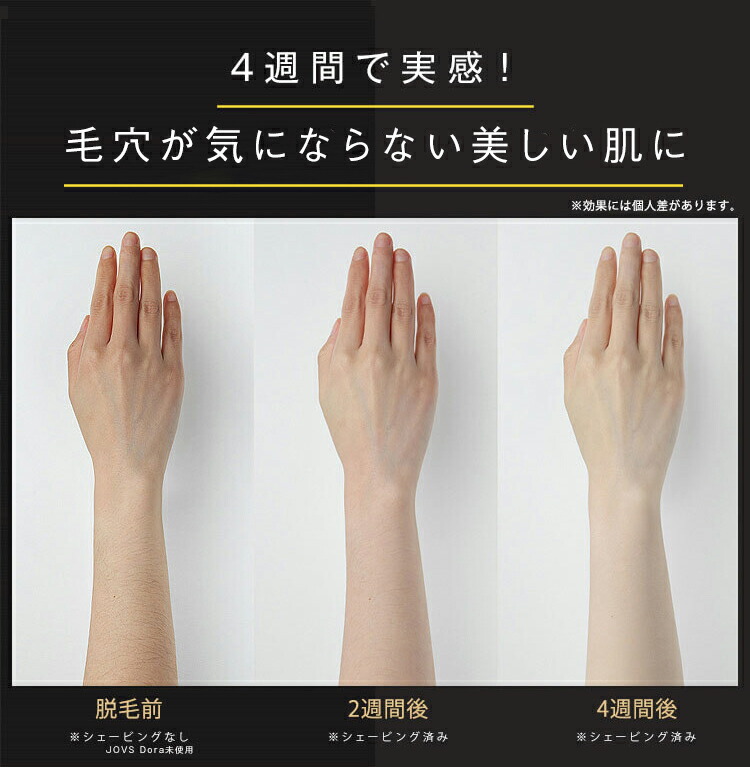 楽天市場】JOVS Dora1 J847モデル ピュアホワイト 脱毛器 ランキング1