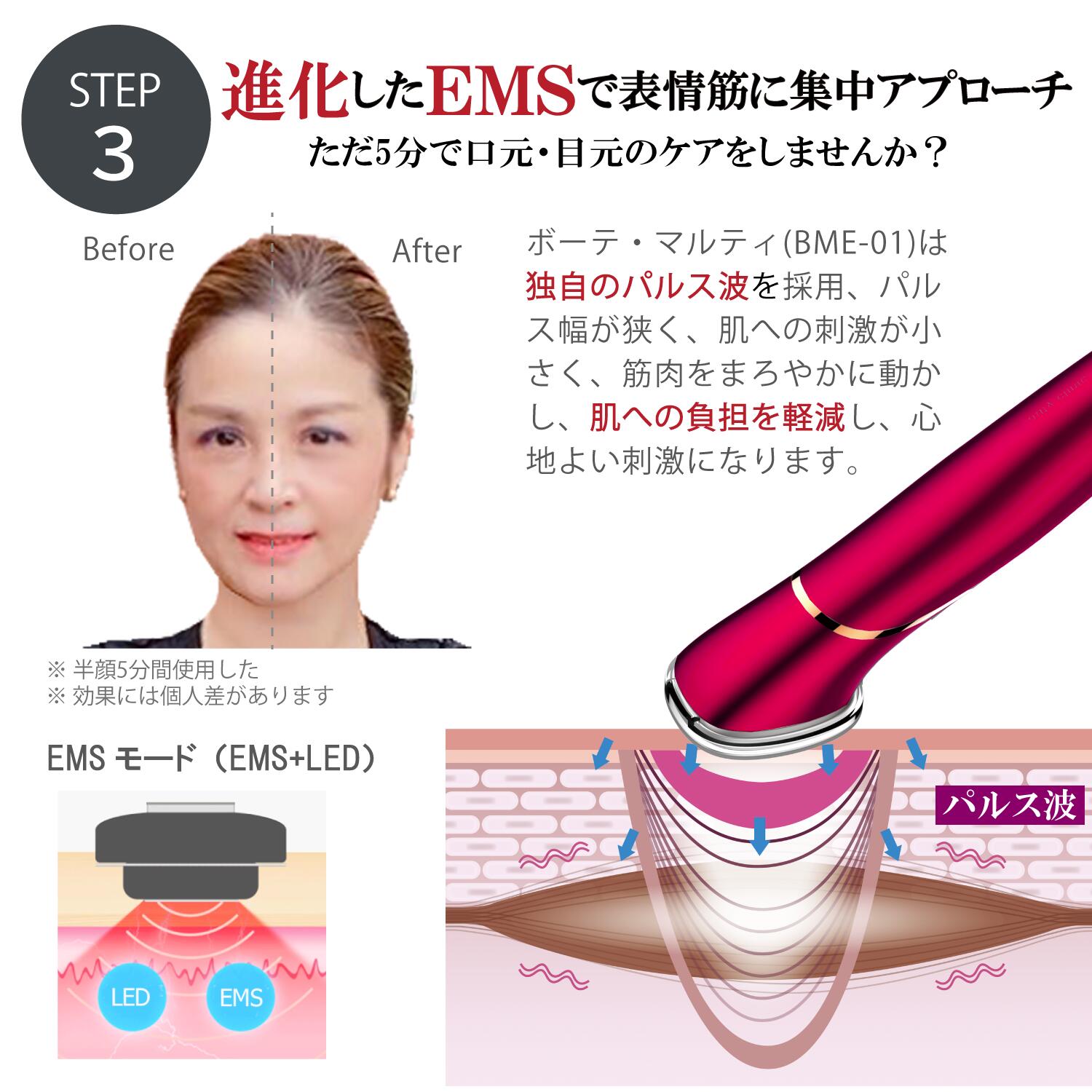 楽天市場】楽天ランキング1位 ems 美顔器 ほうれい線 リフトアップ