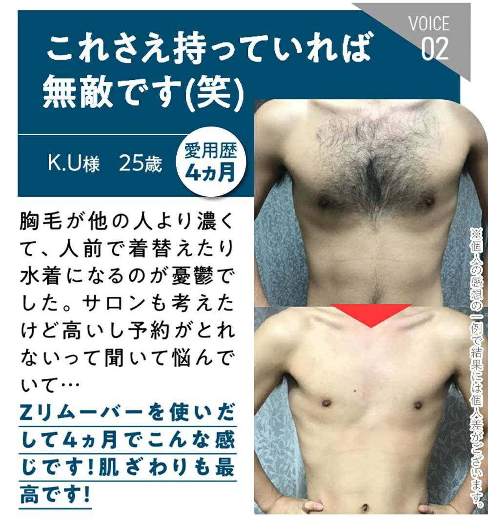 楽天市場】zリムーバー ゼロファクター ZerofactoR 200g 薬用 Z