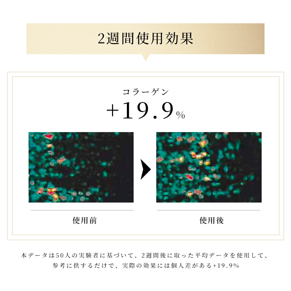 楽天市場】【期間限定 4,500円OFF☆5,480円】美顔器 EMS 顔 美顔器