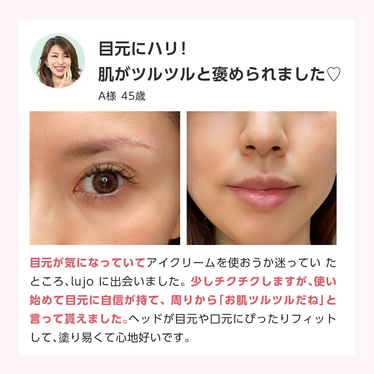 楽天市場】＼メーカー希望小売価格よ35%OFF！／ 【公式】lujo ニードル