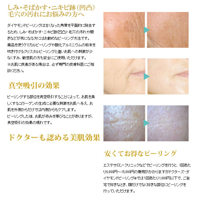 楽天市場】ドクターズダイヤモンドピーリング 美顔器 毛穴 角質除去