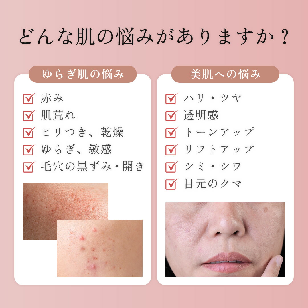 楽天市場】【5,000円OFF&ポイント10倍 3/1〜3/2】可変式RF×可変式EMS×3