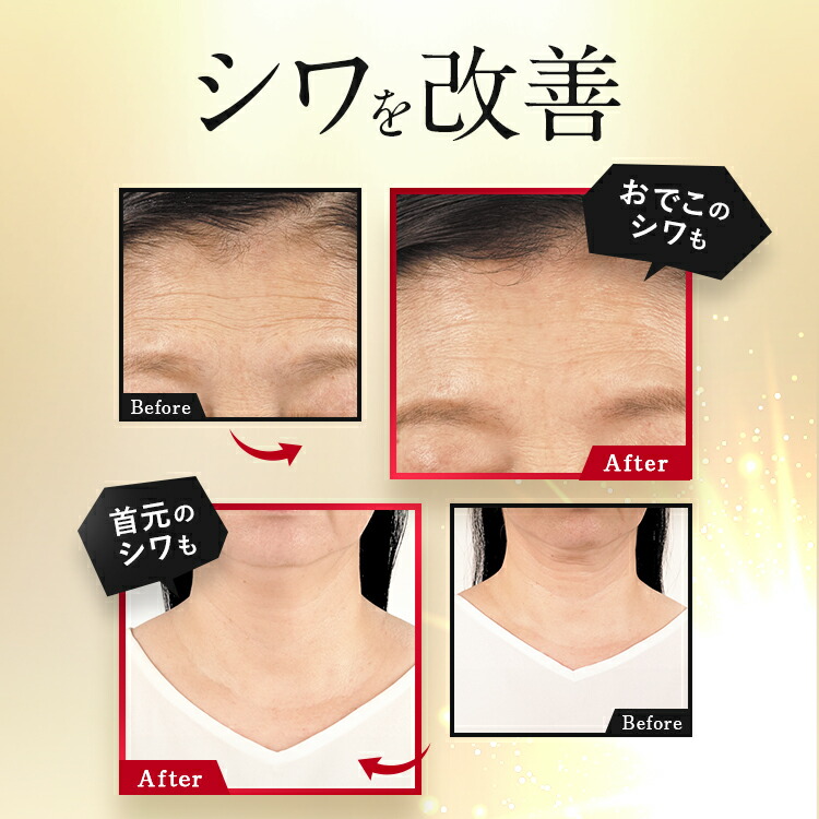 楽天市場】【公式】【詰め替えパウチ】パーフェクトワン 薬用リンクル