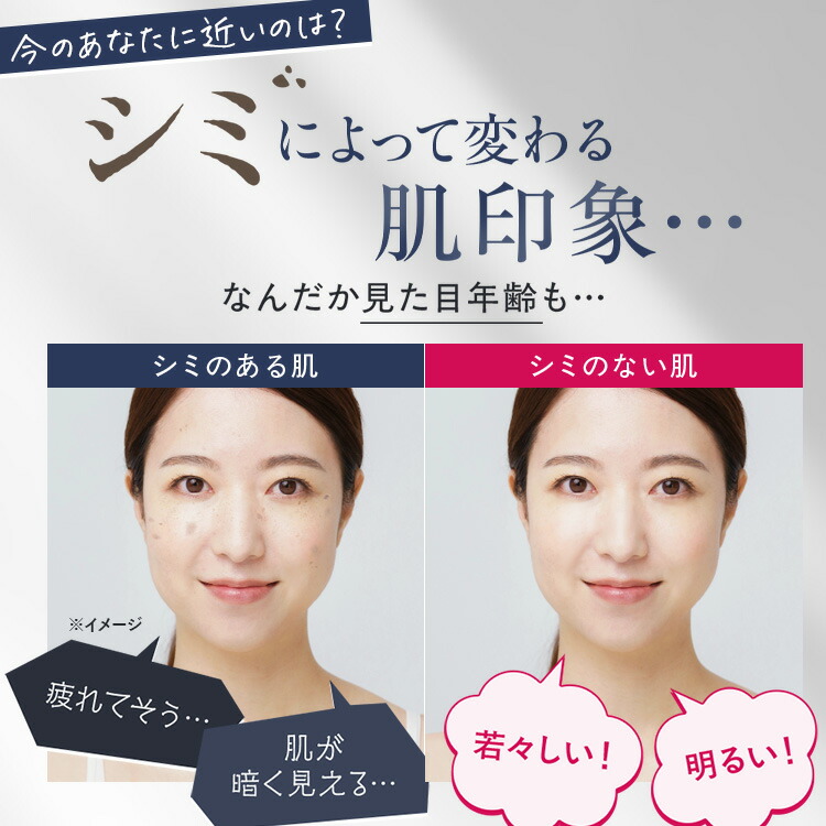 楽天市場】【公式】パーフェクトワン 薬用ホワイトニングジェル 75g