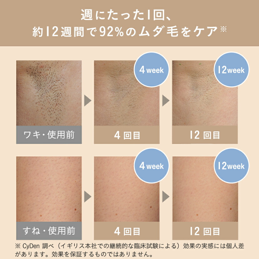 楽天市場】【クーポン利用で24,910円 3/31 8:59まで】脱毛器 痛みレス