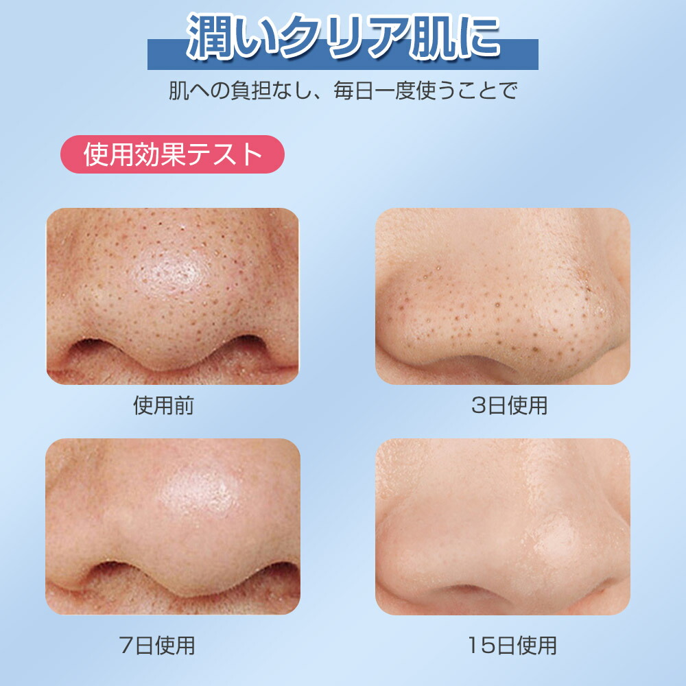 楽天市場】【楽天1位】 毛穴吸引 毛穴吸引器 毛穴ケア 毛穴 吸引 美顔