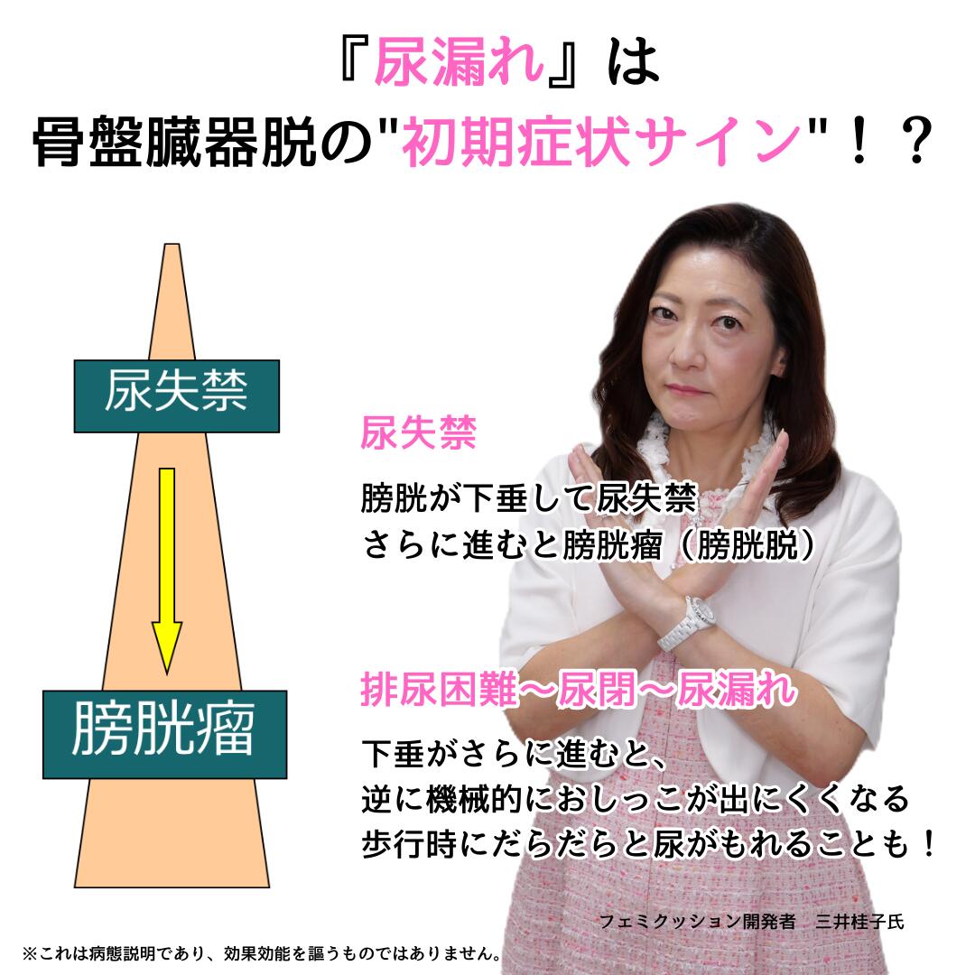 楽天市場】フェミクッション 【スターターキット（ミディコットン