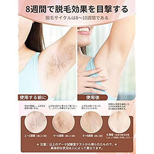 楽天市場】OULISI 脱毛器 光美容器 5段階調節 99万発回照射 IPL光脱毛