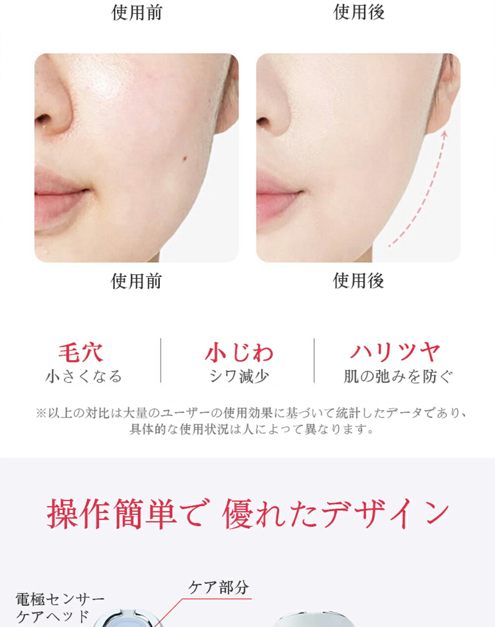 楽天市場】光エステ 美顔器 EMS LED光エステ LEDライトケア イオン導出