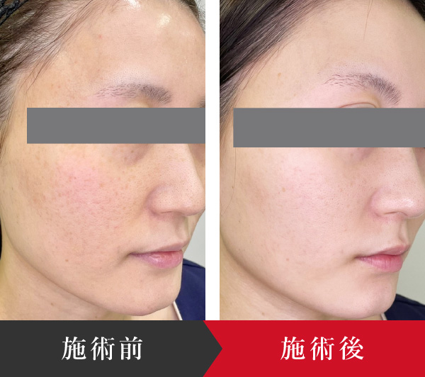 ゼオスキンで朝のメイクが変わる！ミラミンで叶える時短美肌のススメ