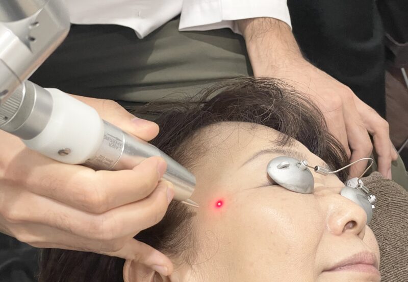 シミ取りレーザー (シミ取り放題) - 銀座・名古屋・心斎橋の美肌治療は