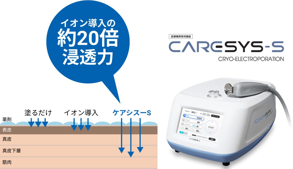 エレクトロポレーション - つくば・土浦鶴町皮膚科クリニック