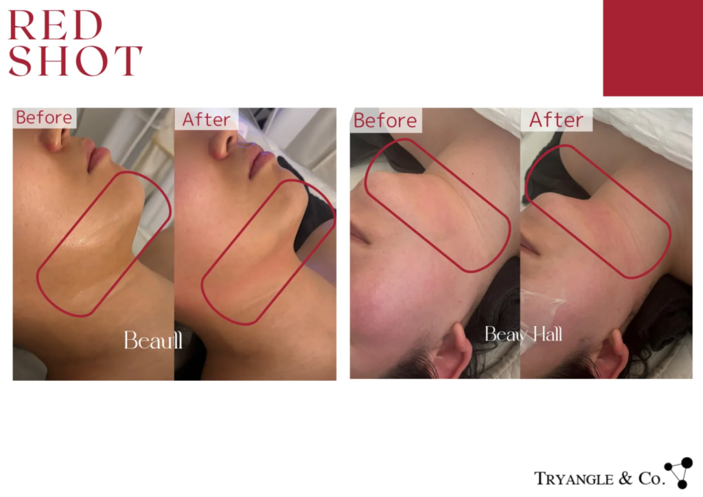 RED SHOT レッドショット - 美容メーカー|トライアングルアンドコー