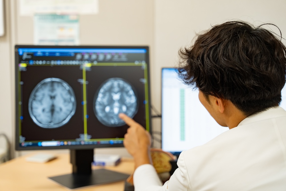横浜市神奈川区の脳神経外科なら、上田クリニックへ｜1.5テスラMRI完備