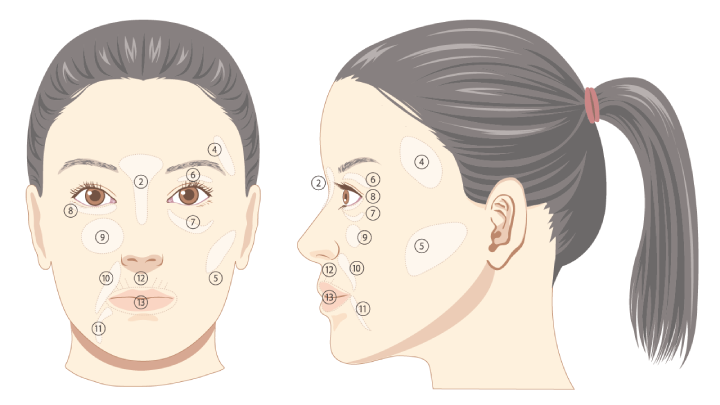 ヒアルロン酸注射 | U CLINIC SHINJUKU