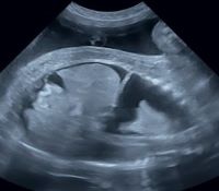 所見から探る産科超音波診断