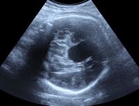 所見から探る産科超音波診断