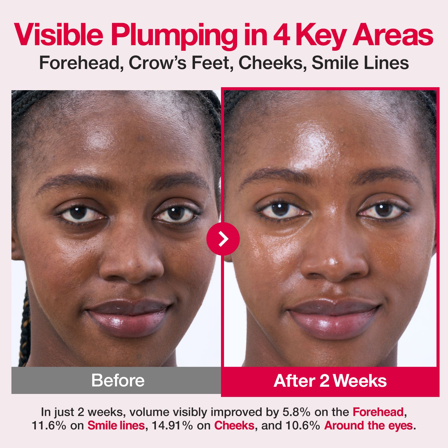 No.2 Rose PDRN Collagen 2X Plumping Serum