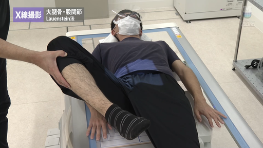 X線撮影 脊椎 外傷患者の撮影法 ｜ Medical*Online Video