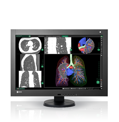 RadiForce RX440 | EIZO