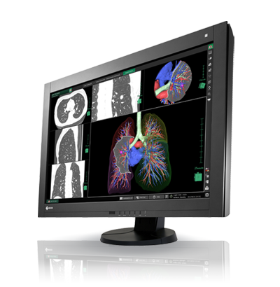 RadiForce RX440 | EIZO