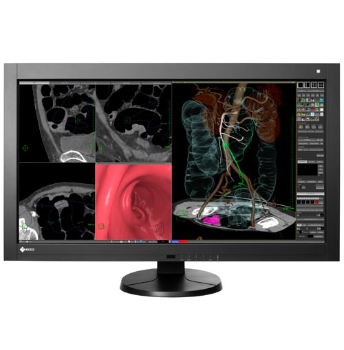 RadiForce RX840 | EIZO