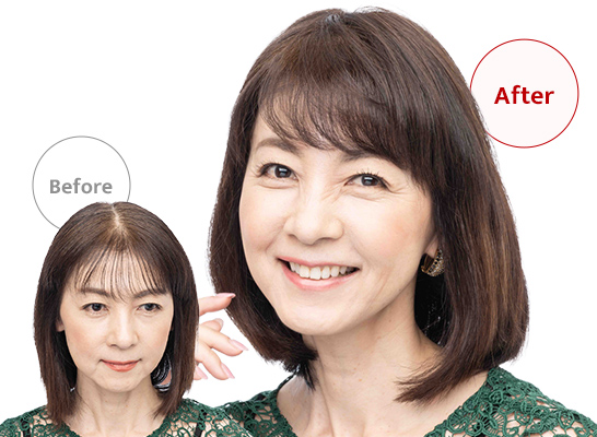 ウィッグユキのポイントウィッグを部分別にご紹介