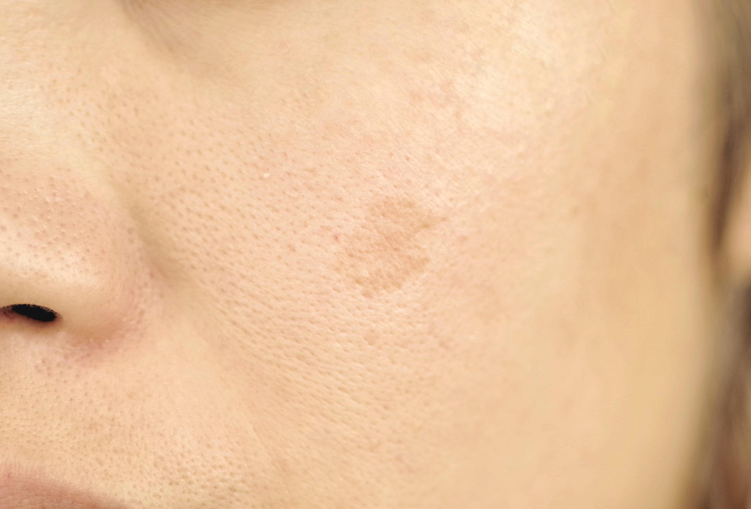 シミ・くすみ - 《公式》ウォブクリニック中目黒