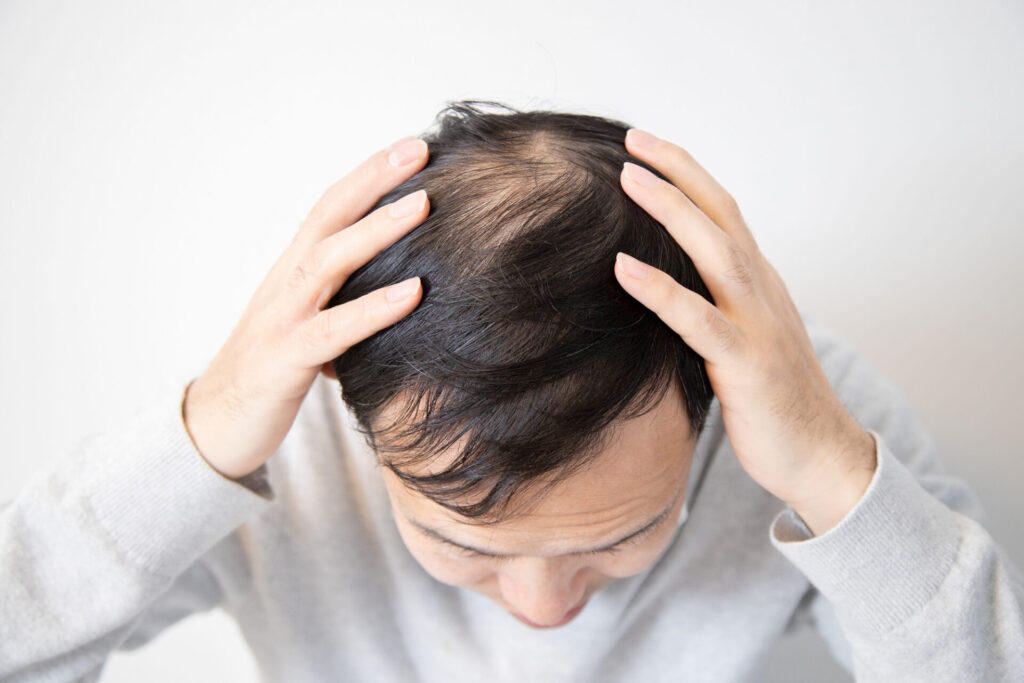 湘南美容推奨】AGA治療後におすすめのシャンプーとは？