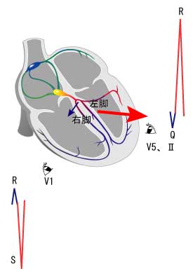 正常興奮伝播による心電図波形のなりたち