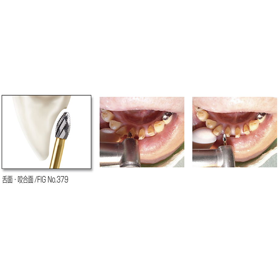 商品情報｜医療従事者向けページ｜歯科器材のクロスフィールド