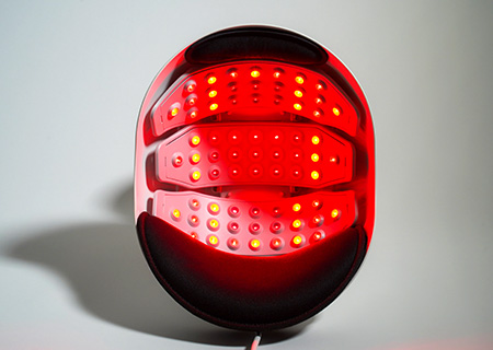 ヘアビームα 低出力レーザー治療 -女性の薄毛治療・FAGA治療は AGA