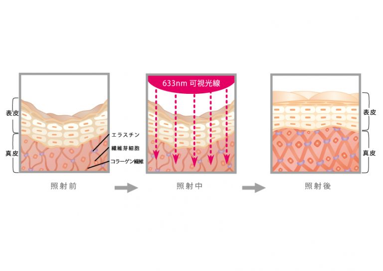 コルポプチ (CORPO putit) | 株式会社アグレックス (美容機器・業務用