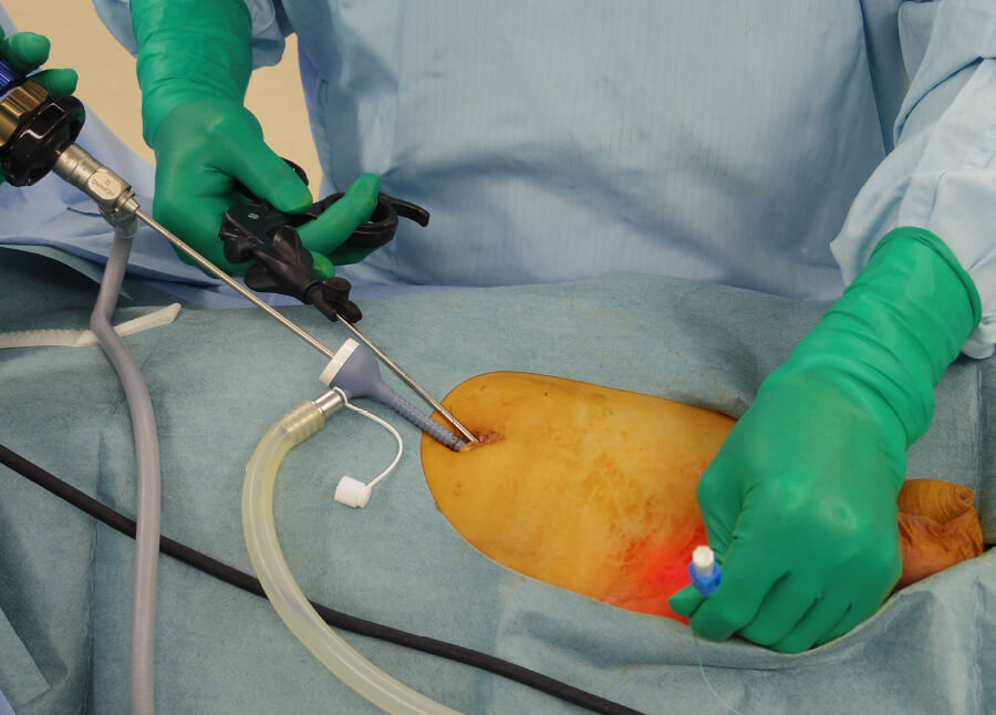 小児外科 - 診療案内 - 愛知医科大学 消化器外科