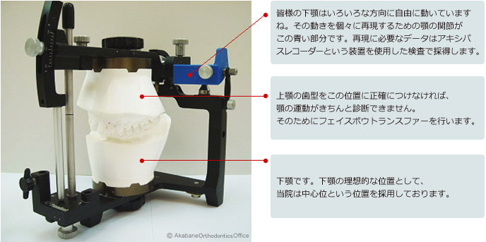 咬合器について｜赤羽矯正歯科｜日本矯正歯科学会（認定）専門医,舌側