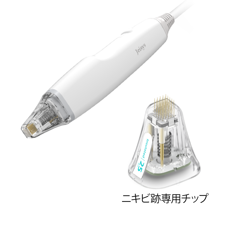 徳島のポテンツァ治療 | 高精度な肌再生で美しい素肌へ | 徳島の美容