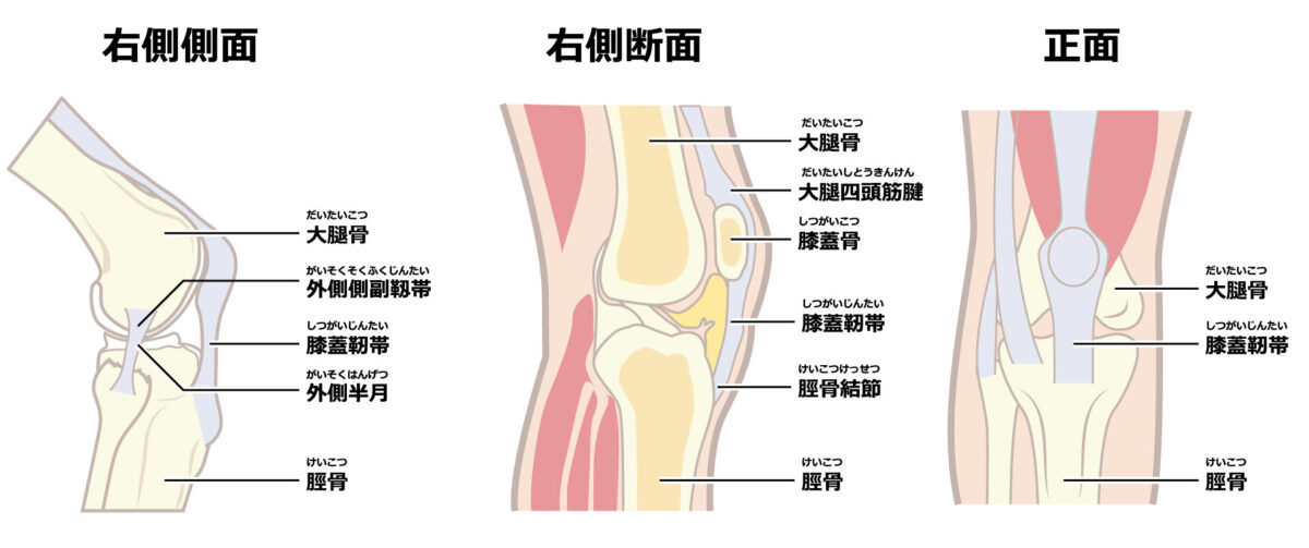 靱帯や軟骨損傷が引き起こす膝の裏の痛みについて | 中山クリニック