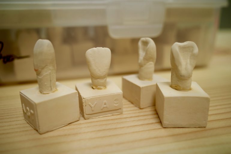 歯型彫刻って、ご存知ですか？ | 平尾【公式】秋月デンタルオフィス