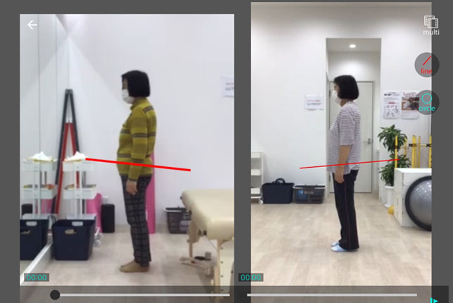 変形性膝関節症・股関節の痛み」でお困りの方専門コース | アスリート