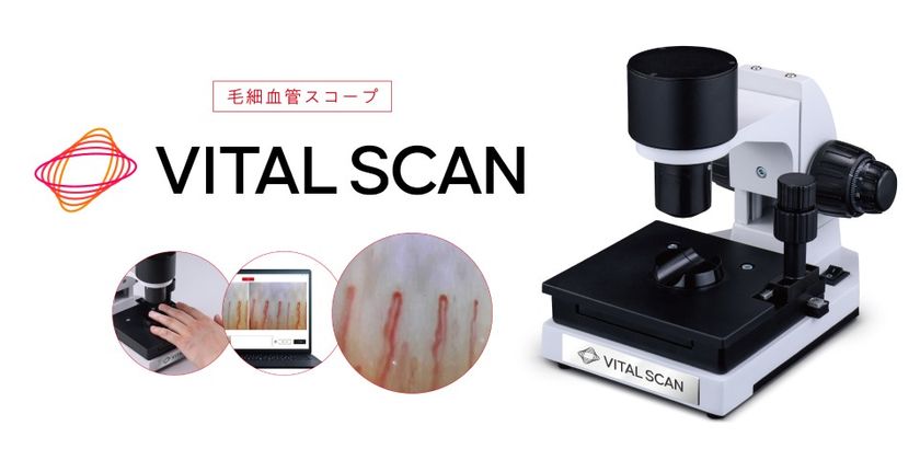 血行に着目した健康意識向上の取り組み 毛細血管スコープ「VITAL SCAN