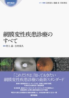 最新 網膜循環疾患コンプリートガイド－所見・検査，疾患と診断・治療