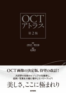 新OCT・OCTA読影トレーニング 改訂第2版 - 眼科専門書店 オー・ビー
