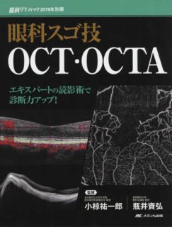 新OCT・OCTA読影トレーニング 改訂第2版 - 眼科専門書店 オー・ビー