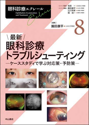 最新 眼科診療トラブルシューティング [眼科診療エクレール 8] - 眼科