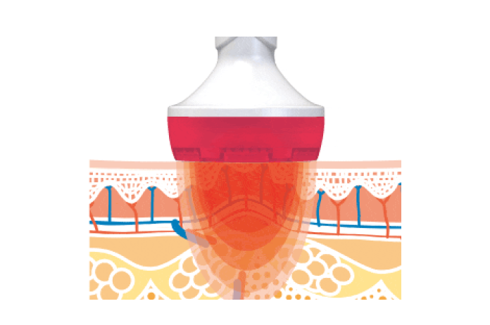 CELLTUNE(セルチューン) | ボディケア | 伊藤超短波 エステ関係者向け